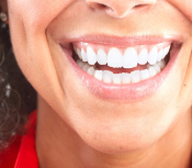 Durham Dentist Teeth Whitening